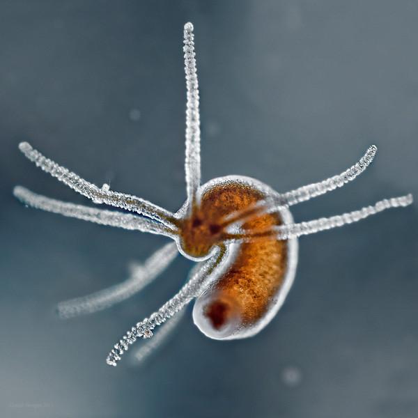 An unidentified species of hydra. Image via microworldsphotography.