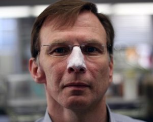 Dr. Pedersen modeling opaque white sunblock on his nose